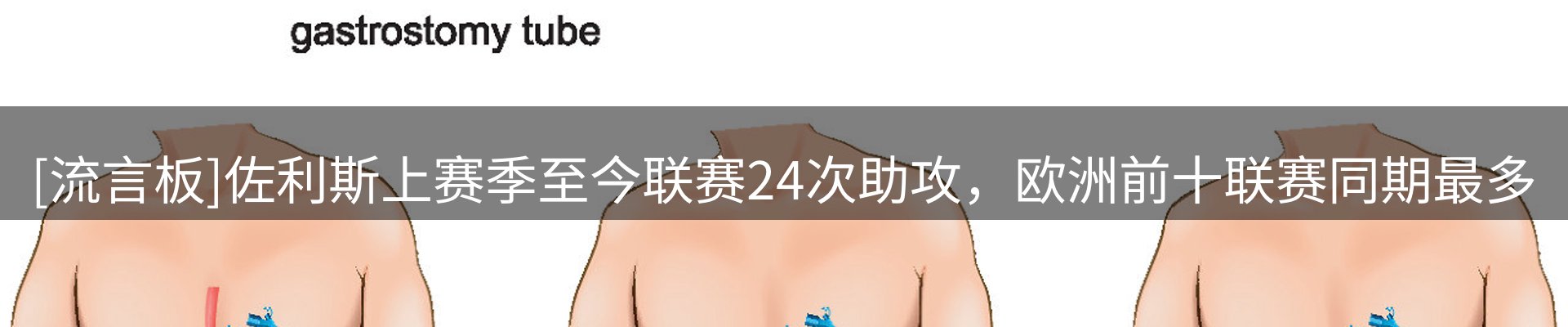 今日快讯